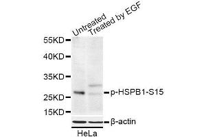Western blot analysis of extracts of HeLa cells, using Phospho-HSPB1-S15 antibody (ABIN5969897) at 1/1000 dilution. (HSP27 抗体  (pSer15))