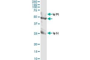 Immunoprecipitation of TALDO1 transfected lysate using anti-TALDO1 MaxPab rabbit polyclonal antibody and Protein A Magnetic Bead , and immunoblotted with TALDO1 MaxPab rabbit polyclonal antibody (D01) . (TALDO1 抗体  (AA 1-337))