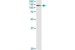 Western Blotting (WB) image for anti-AXL Receptor tyrosine Kinase (AXL) (AA 30-140) antibody (ABIN560017)