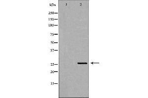 Western blot analysis of transfected 293T cell line, using ELSPBP1 Antibody. (ELSPBP1 抗体  (C-Term))
