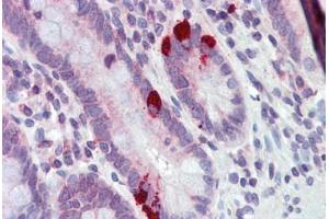 Immunohistochemistry (Paraffin-embedded Sections) (IHC (p)) image for anti-Solute Carrier Family 39 (Metal Ion Transporter), Member 5 (SLC39A5) (AA 38-87) antibody (ABIN6741604)