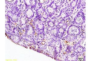Formalin-fixed and paraffin embedded rat colitis labeled with Anti-IL-12 Polyclonal Antibody, Unconjugated (ABIN672951) at 1:200, followed by conjugation to the secondary antibody and DAB staining (IL12A 抗体  (AA 51-150))
