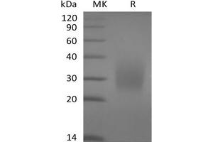 CD79a Protein (His tag)