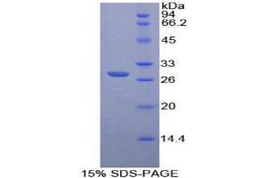 SDS-PAGE analysis of Human PTPRM Protein. (PTPRM 蛋白)