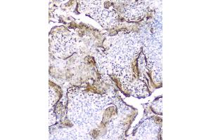 IHC analysis of Elafin using anti-Elafin antibody (ABIN5693295).