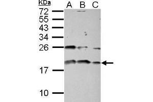 WB Image Sample (30 ug of whole cell lysate) A: PC-3 B: U87-MG C: SK-N-SH 15% SDS PAGE antibody diluted at 1:1000