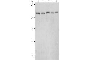 Western Blotting (WB) image for anti-RAD50 Homolog (S. Cerevisiae) (RAD50) antibody (ABIN2426374) (RAD50 抗体)
