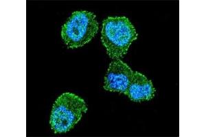 Confocal immunofluorescent analysis of LKB1 antibody with ZR-75-1 cells followed by Alexa Fluor 488-conjugated goat anti-rabbit lgG (green). (LKB1 抗体  (AA 19-48))
