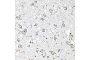 Immunohistochemistry of paraffin-embedded rat brain using FGF1 antibody at dilution of 1:100 (x40 lens). (FGF1 抗体)