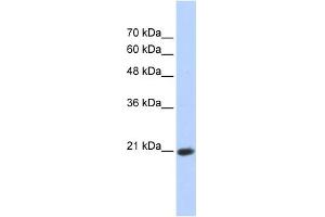 WB Suggested Anti-TCEAL8 Antibody Titration:  0. (TCEAL8 抗体  (Middle Region))