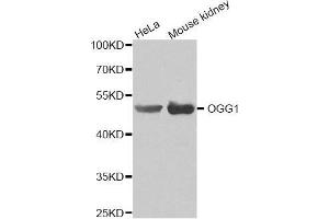 Western blot analysis of extracts of various cell lines, using OGG1 antibody(1:200). (OGG1 抗体)