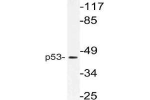 Western blot (WB) analysis of p53 antibody in extracts from HT-29 cells. (p53 抗体)