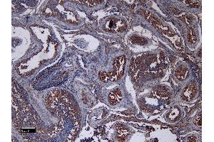 Immunohistochemistry (IHC) image for anti-Angiotensin I Converting Enzyme 2 (ACE2) (N-Term) antibody (ABIN7505816)