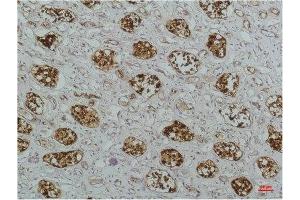 Immunohistochemical analysis of paraffin-embedded Human Kidney Tissue using IκB βMouse mAb diluted at 1:200.