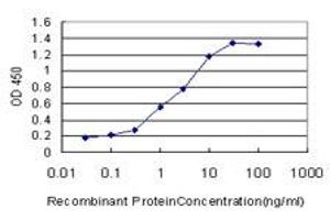 Detection limit for recombinant GST tagged ANKRD15 is approximately 0. (ANKRD15 抗体  (AA 701-800))