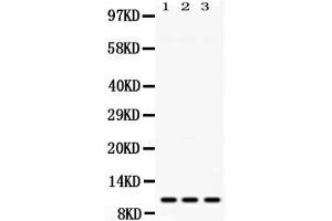 Western blot analysis of MPS1 expression in rat spleen extract ( Lane 1), mouse liver extract ( Lane 2) and HELA whole cell lysates ( Lane 3). (RPS27 抗体  (AA 2-84))