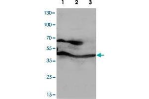 Western blot analysis of whole cell lysates with PPID polyclonal antibody . (PPID 抗体  (C-Term))