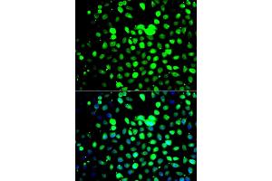 Immunofluorescence analysis of A549 cells using ZBTB25 antibody (ABIN4905657). (ZBTB25 抗体)