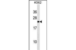 NOP16 Antibody (C-term) (ABIN1536695 and ABIN2850316) western blot analysis in K562 cell line lysates (35 μg/lane). (NOP16 抗体  (C-Term))