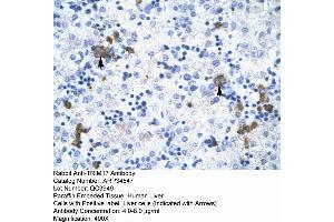 Human Liver (TRIM17 / RNF16 抗体  (Middle Region))