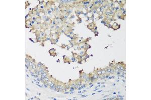 Immunohistochemistry of paraffin-embedded human prostate using NEDD4L antibody at dilution of 1:200 (40x lens).