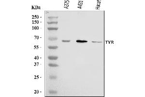 Western blot analysis of Tyrosinase/TYR using anti-Tyrosinase/TYR antibody (ABIN7599956).