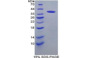 SDS-PAGE analysis of Mouse IRF6 Protein. (IRF6 蛋白)