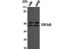Western Blotting (WB) image for anti-Glycogen Synthase Kinase 3 alpha/beta (GSK3a/b) (Tyr216), (Tyr279) antibody (ABIN5956808) (GSK3 alpha/beta 抗体  (Tyr216, Tyr279))