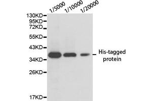 Image no. 3 for anti-His Tag antibody (ABIN2932978) (His Tag 抗体)