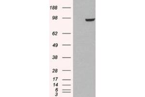 Western Blotting (WB) image for anti-phosphodiesterase 5A, cGMP-Specific (PDE5A) (C-Term) antibody (ABIN2466086) (PDE5A 抗体  (C-Term))