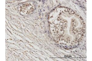 Immunoperoxidase of monoclonal antibody to ZNF92 on formalin-fixed paraffin-embedded human prostate. (ZNF92 抗体  (AA 490-586))