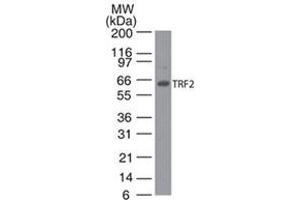 TRF2 Western Blot. (TRF2 抗体)
