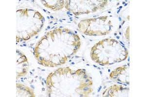 Immunohistochemistry of paraffin-embedded Human stomach using PCDHA12 Polyclonal Antibody at dilution of 1:100 (40x lens). (PCDHA12 抗体)
