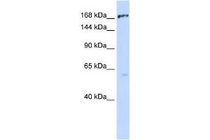 Western Blotting (WB) image for anti-ATP-Binding Cassette, Sub-Family C (CFTR/MRP), Member 1 (ABCC1) antibody (ABIN2458767) (ABCC1 抗体)