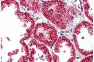 Human Kidney: Formalin-Fixed, Paraffin-Embedded (FFPE) (HINT1 抗体  (AA 38-87))