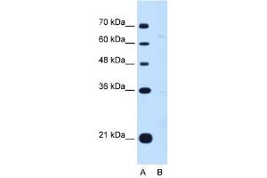 DONSON antibody used at 1 ug/ml to detect target protein. (DONSON 抗体  (Middle Region))