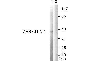 Immunohistochemistry analysis of paraffin-embedded human brain tissue using Arrestin 1 (Ab-412) antibody. (SAG 抗体  (Ser412))
