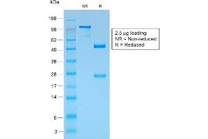 SDS-PAGE Analysis Purified gp100 Rabbit Recombinant Monoclonal Antibody (PMEL/1825R). (Recombinant Melanoma gp100 抗体)