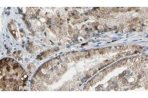 ABIN6273398 at 1/100 staining Human prostate tissue by IHC-P. (SLC34A2 抗体  (N-Term))