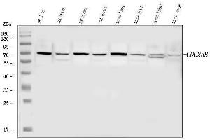 Western blot analysis of CDC25B using anti-CDC25B antibody (ABIN7599434).