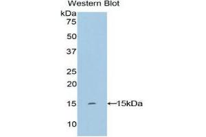 Western Blotting (WB) image for anti-Keratin 2 (KRT2) (AA 7-160) antibody (ABIN1859577) (Keratin 2 抗体  (AA 7-160))