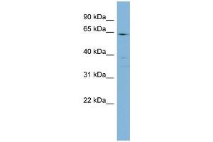 Western Blotting (WB) image for anti-Cytochrome P450, Family 4, Subfamily F, Polypeptide 3 (CYP4F3) (N-Term) antibody (ABIN2777012)