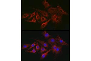 Immunofluorescence analysis of C6 cells using α-Tubulin Mouse mAb (ABIN7271035) at dilution of 1:100 (40x lens). (TUBA4A 抗体)