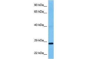 Western Blotting (WB) image for anti-Chloride Intracellular Channel 1 (CLIC1) (N-Term) antibody (ABIN2776130)