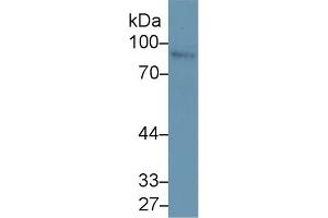 Western Blotting (WB) image for anti-Nexilin (NEXN) (AA 214-455) antibody (ABIN7439642)