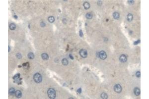 Detection of FUM in Human Liver Tissue using Polyclonal Antibody to Fumarase (FUM) (FH 抗体  (AA 45-188))
