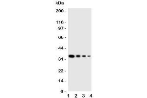 Western blot testing of PKR antbody;  Lane 1: Recombinant human protein 10ng;  2: 5ng;  3: 2.