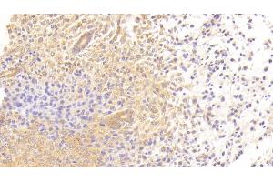 Detection of TGFbR3 in Mouse Uterus Tissue using Polyclonal Antibody to Transforming Growth Factor Beta Receptor III (TGFbR3) (TGFBR3 抗体  (AA 469-724))