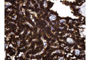 Image no. 5 for anti-TAP Binding Protein-Like (TAPBPL) antibody (ABIN1501302)