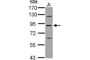 WB Image Sample (30 ug of whole cell lysate) A: U87-MG 7. (PLA2G6 抗体)